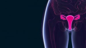 رادیوتراپی اصفهان صحبت های دکتر پوریا عادلی با موضوع سرطان دهانه رحم